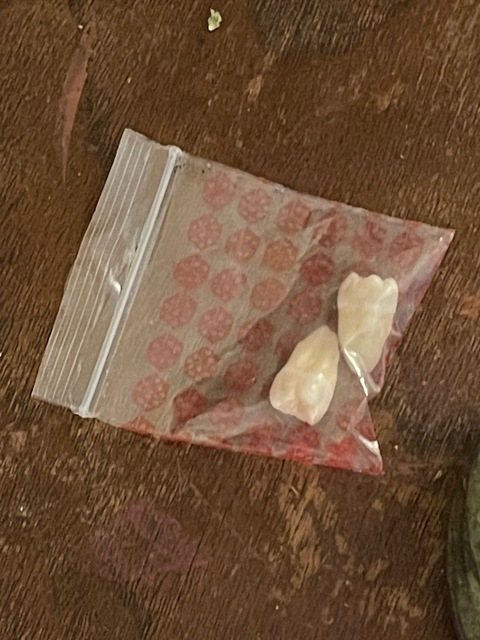 foodforth0t onlyfans leaked picture 2